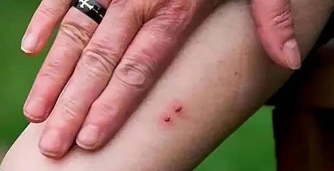 后续！27岁女游客三亚被蛇咬身亡：家属追责医院海南卫健委介入(图4)