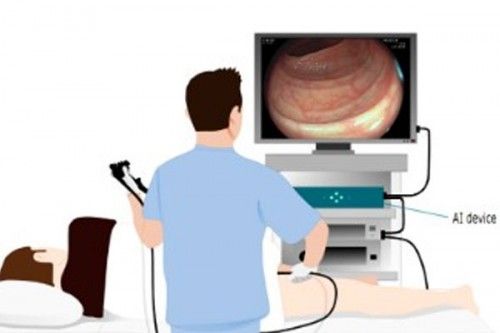 九游app：柳叶刀惊曝：AI让医生6个月「废功」20%癌症检出率崩盘！(图5)