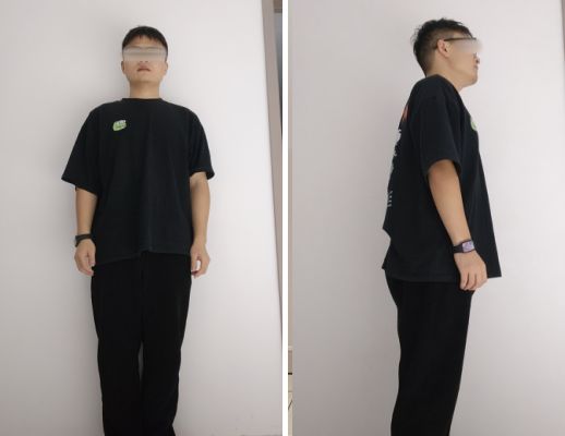 九游官网入口：重度脂肪肝逆转！半年科学减重25公斤！这位小伙迎来新生(图4)