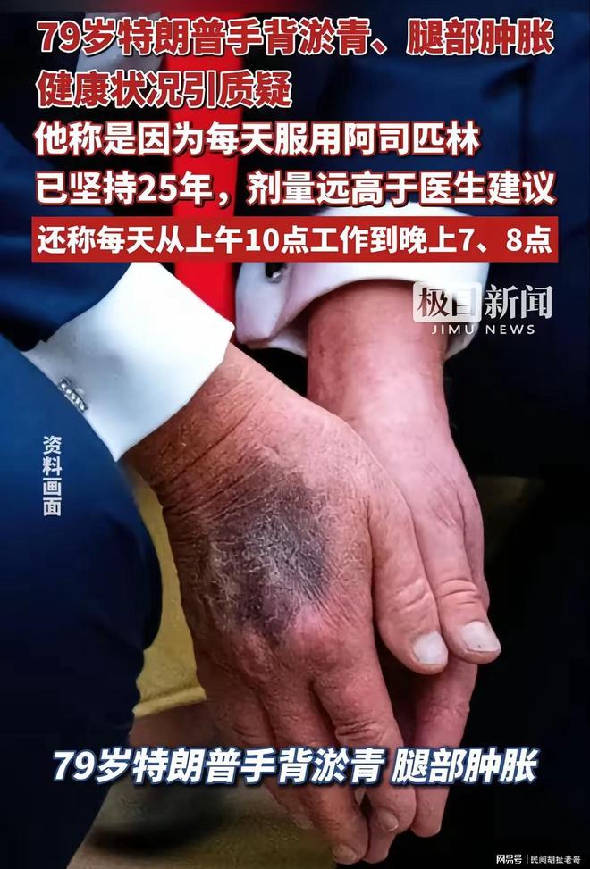 80岁的特朗普凭啥比年轻人还能折腾？——让养生博主集体沉默(图1)
